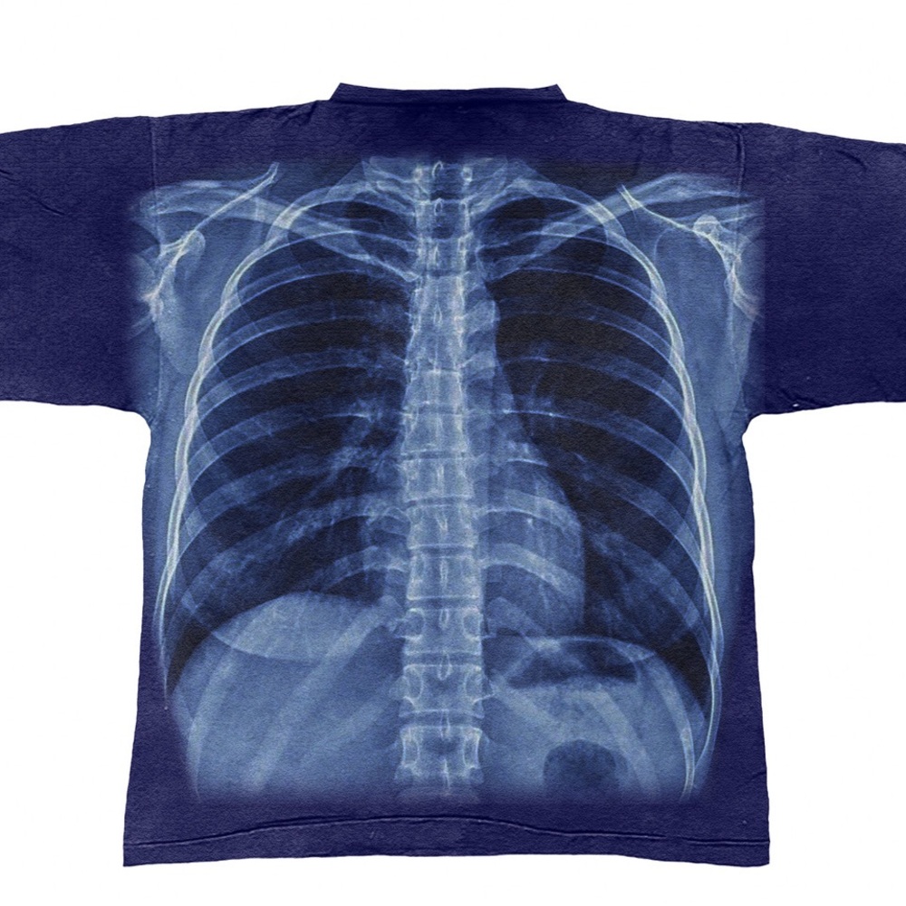 COPY - X-Ray Riches Tee - Picture 3 of 6